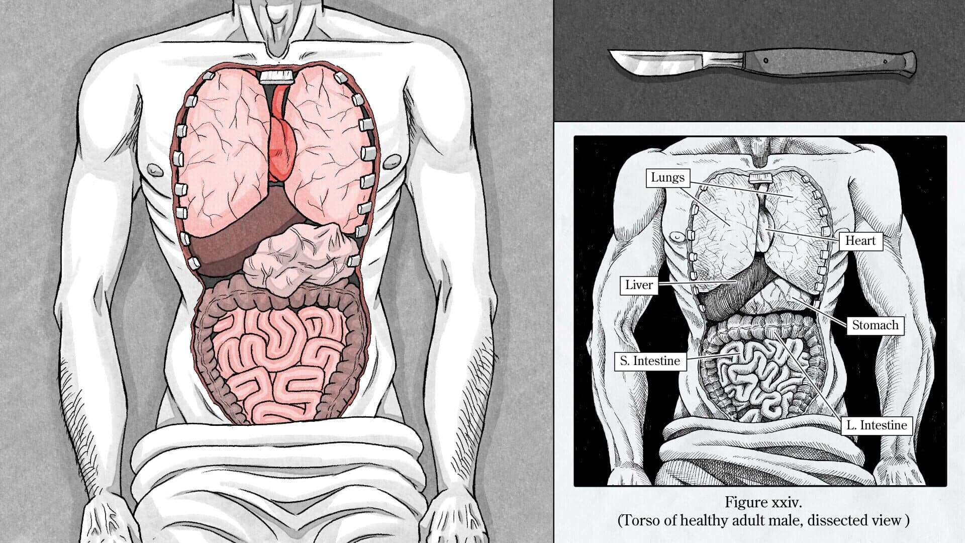 Screenshot for Edwin Earstwhile: Medical Examiner
