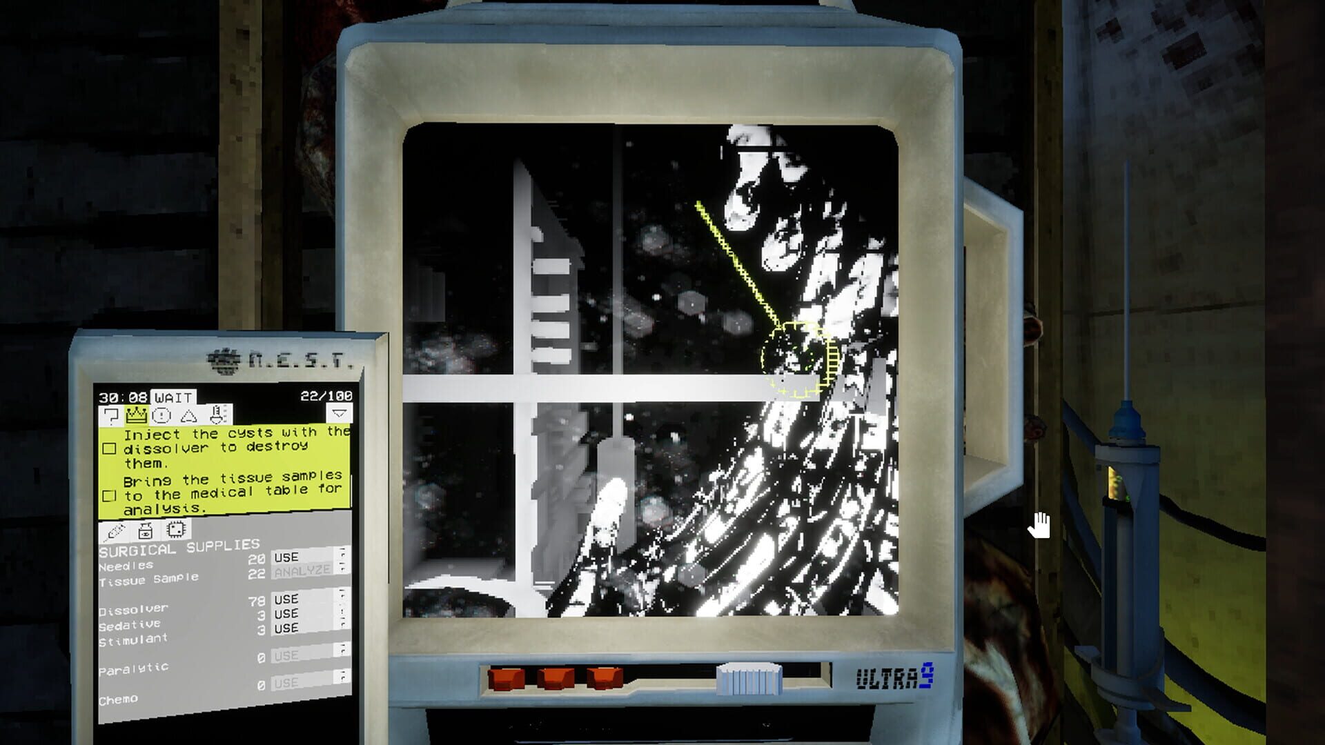 Screenshot for Ultrasound