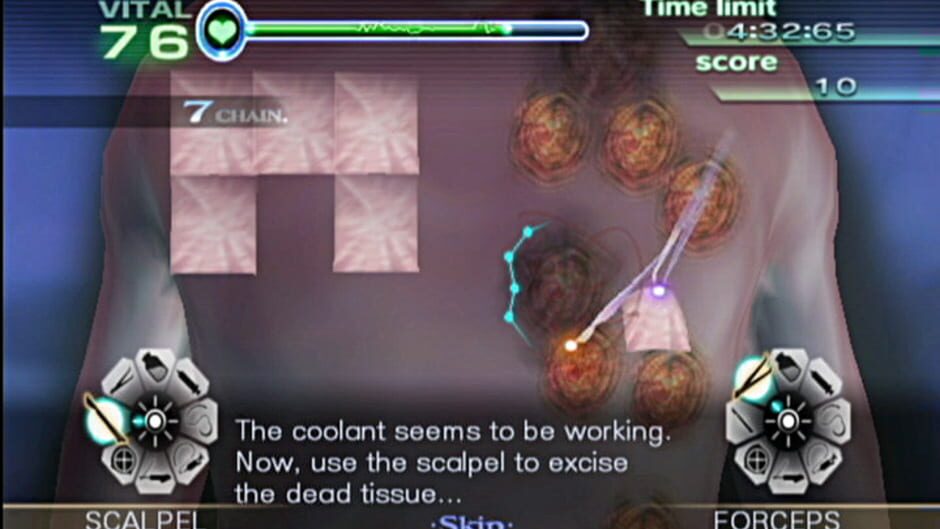 Screenshot for Trauma Center: New Blood