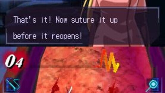 Screenshot for Trauma Center: Under the Knife