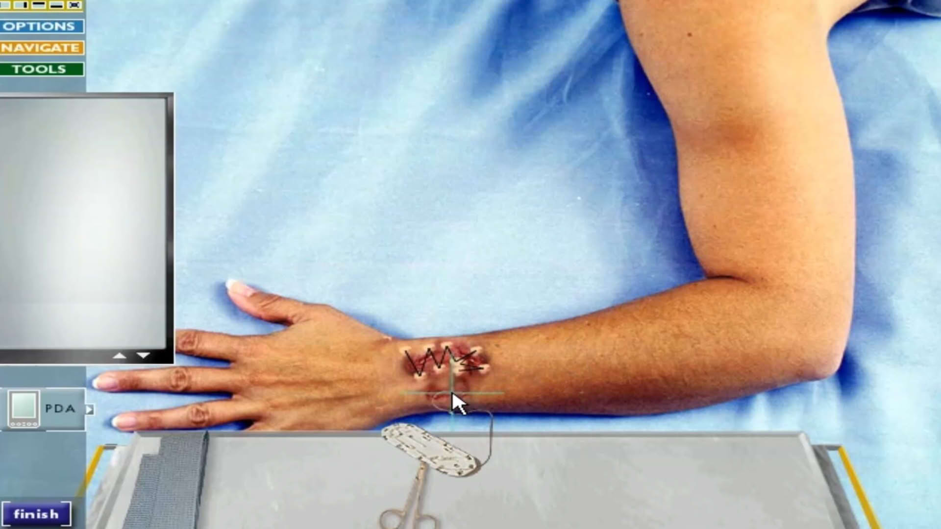 Screenshot for Code Blue