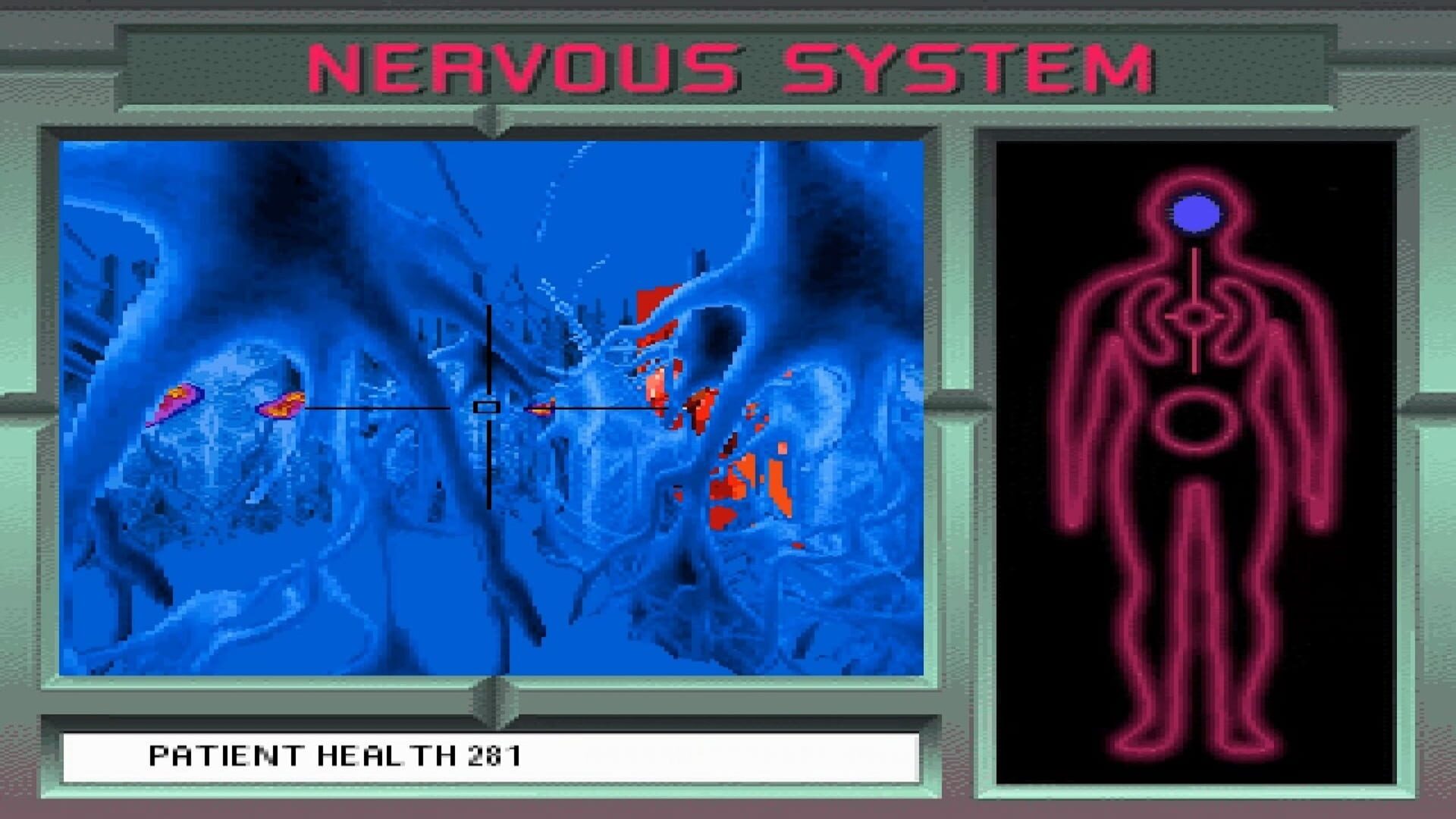 Screenshot for 3-D Body Adventure