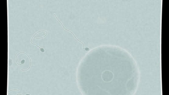 Screenshot for Coil