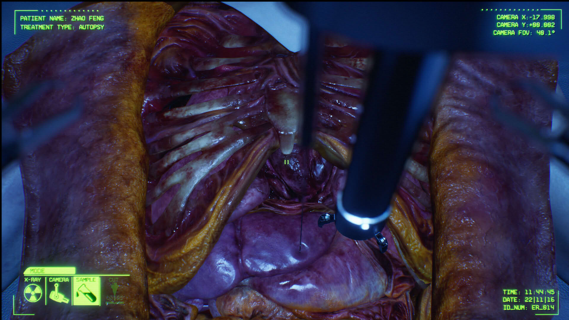 Screenshot for Negative Atmosphere: Emergency Room