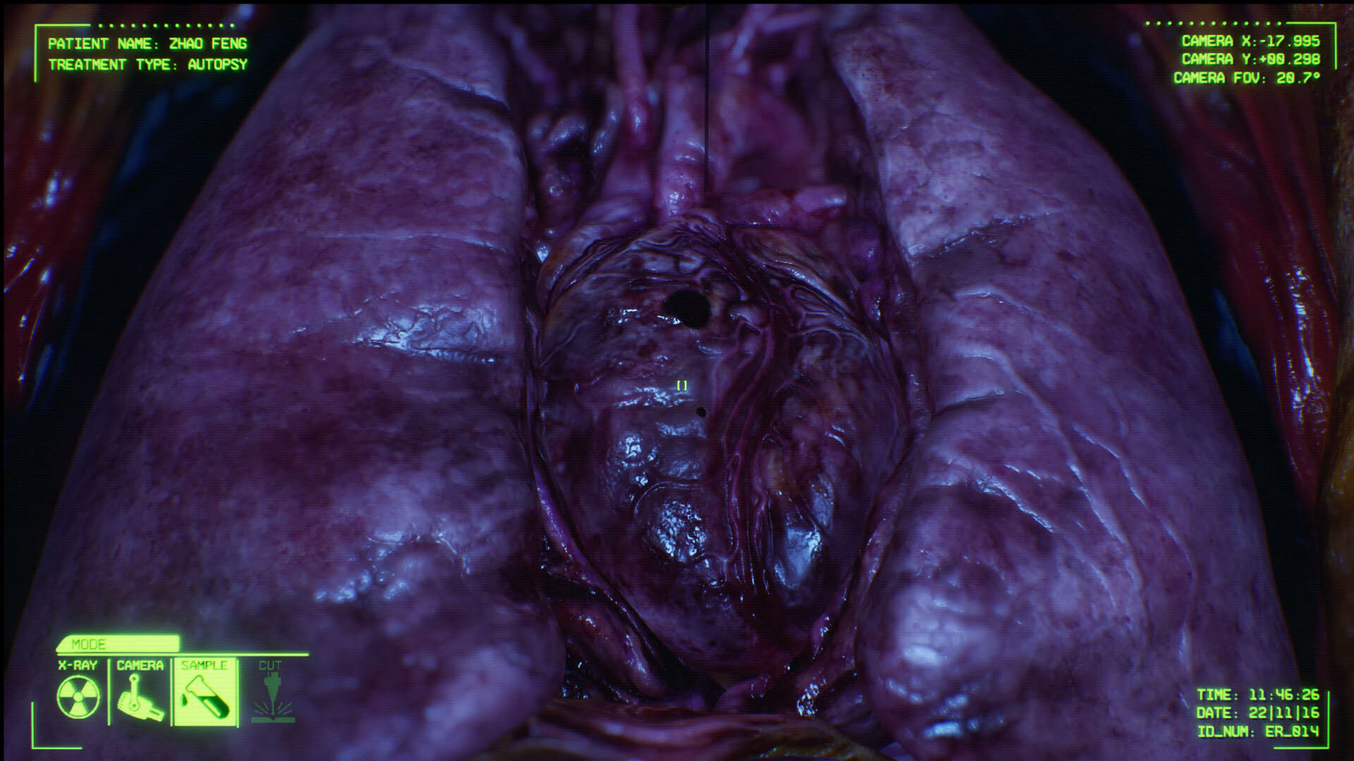 Screenshot for Negative Atmosphere: Emergency Room