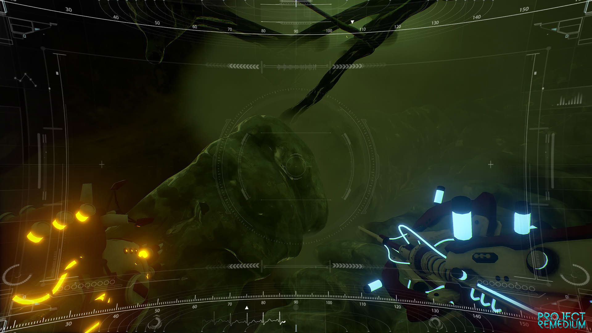 Screenshot for Project Remedium