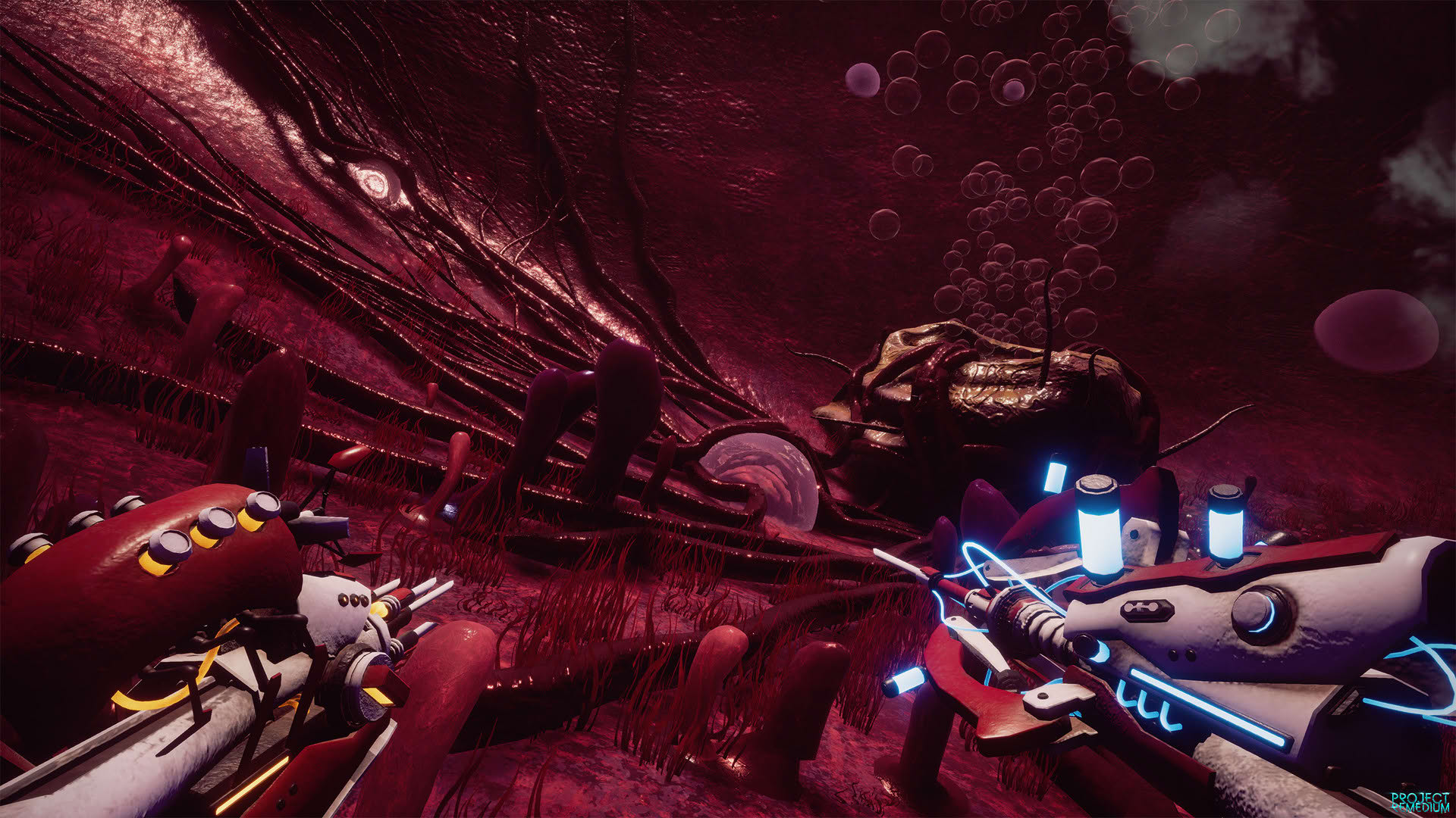Screenshot for Project Remedium